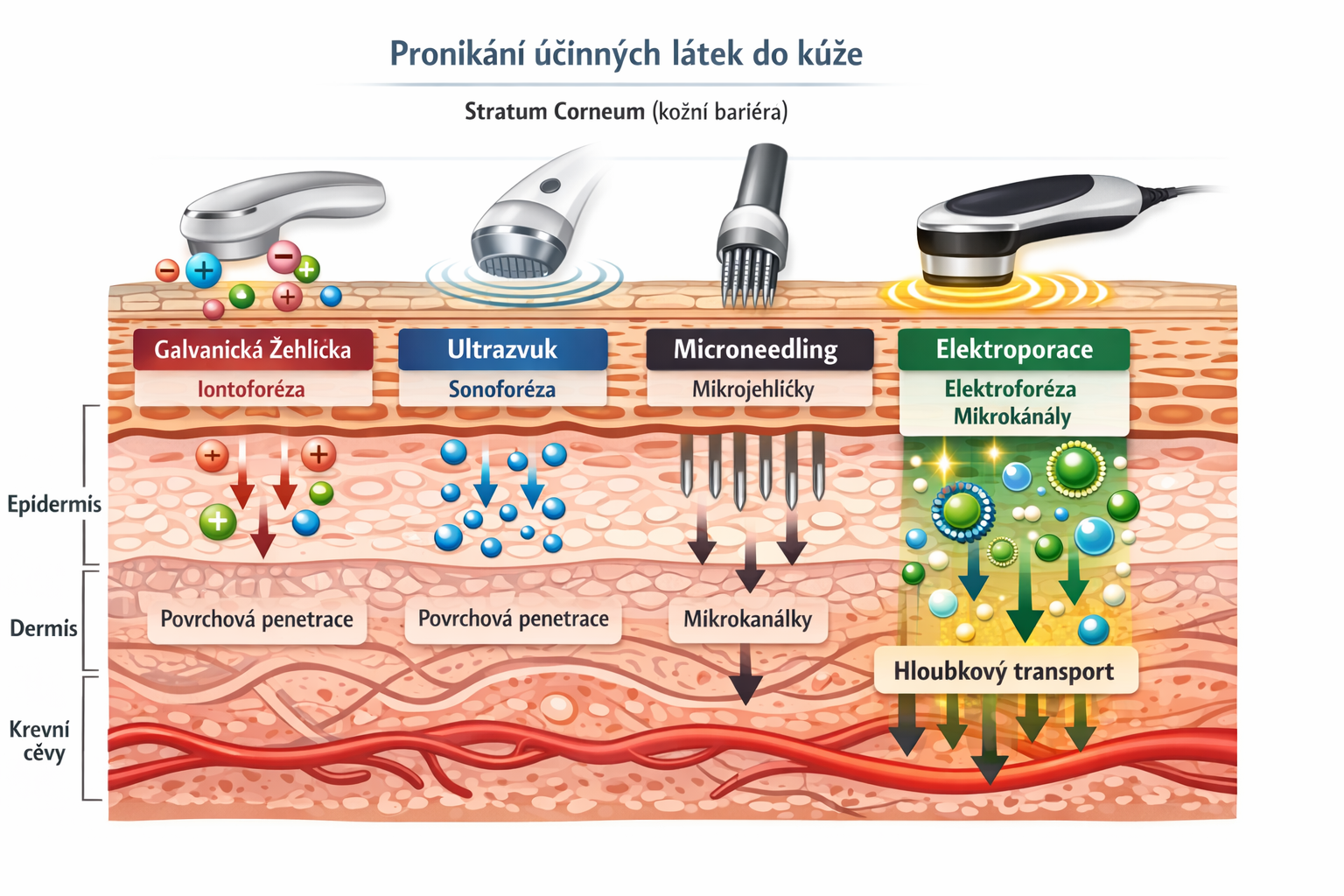 PROČ ELEKTROPORACE PRACUJE S NANOČÁSTICEMI LÉPE NEŽ MICRONEEDLING, ULTRAZVUK NEBO GALVANICKÁ ŽEHLIČKA